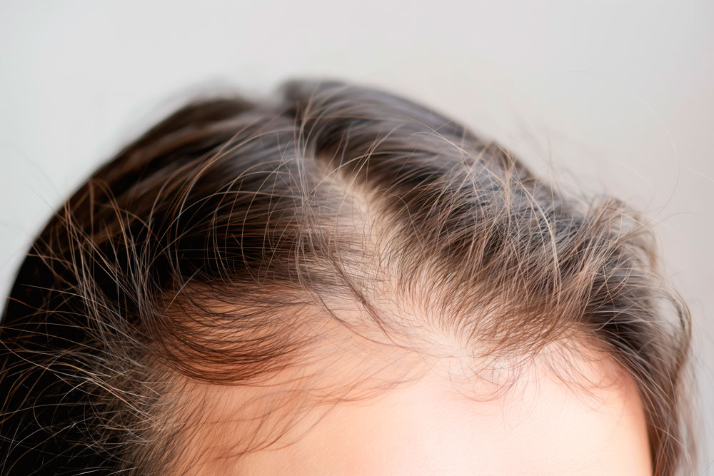 Doenças do cabelo e unhas